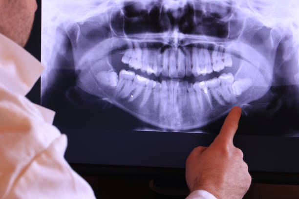 Best Emergency Broken Tooth Repair in Marin City, CA